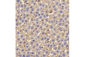 Immunohistochemistry of paraffin embedded rat liver using AHSG (ABIN7073021) at dilution of 1:700 (400x lens) (Fetuin A antibody)
