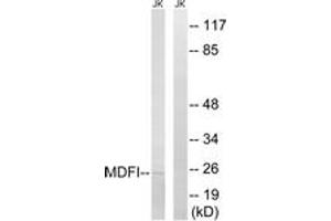 Western blot analysis of extracts from Jurkat cells, using MDFI Antibody. (MDFI antibody  (AA 103-152))