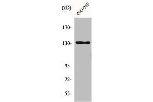Western Blot analysis of COLO205 cells using JMY Polyclonal Antibody (JMY antibody  (C-Term))