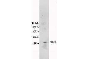 L1 mouse cerebrum lysates, probed: Anti-Bax (ABIN725375) at 1:300 in 4 °C. (BAX antibody  (AA 84-175))