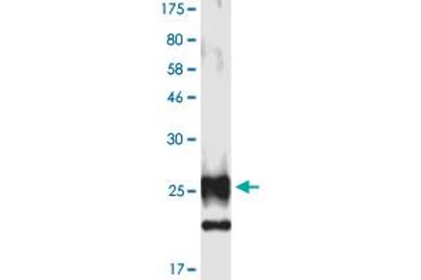 Ectodysplasin A Protein (EDA) (AA 245-391) (His-DYKDDDDK-Strep II Tag)