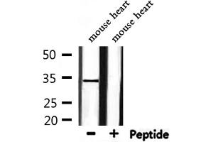 Western blot analysis of extracts from mouse heart, using HP1gamma Antibody.