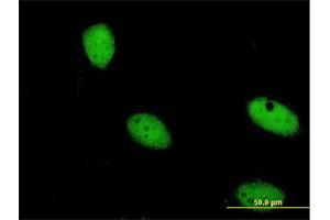 Immunofluorescence of monoclonal antibody to ZNF274 on HeLa cell. (ZNF274 antibody  (AA 420-530))