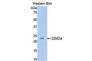 Western Blotting (WB) image for anti-Slit Homolog 1 (SLIT1) (AA 611-791) antibody (ABIN1860575) (SLIT1 antibody  (AA 611-791))