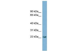 WB Suggested Anti-PERP  Antibody Titration: 0.