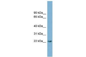 WB Suggested Anti-PERP  Antibody Titration: 0. (PERP antibody  (Middle Region))