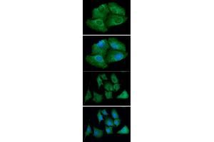 ICC/IF analysis of TXNRD1 in Hep3B cells line, stained with DAPI (Blue) for nucleus staining and monoclonal anti-human TXNRD1 antibody (1:100) with goat anti-mouse IgG-Alexa fluor 488 conjugate (Green). (TXNRD1 antibody)