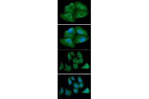ICC/IF analysis of TXNRD1 in Hep3B cells line, stained with DAPI (Blue) for nucleus staining and monoclonal anti-human TXNRD1 antibody (1:100) with goat anti-mouse IgG-Alexa fluor 488 conjugate (Green).