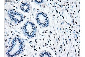 Immunohistochemical staining of paraffin-embedded breast tissue using anti-BRAF mouse monoclonal antibody. (BRAF antibody)