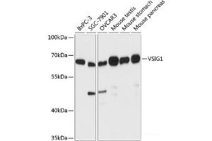 Western blot analysis of extracts of various cell lines using VSIG1 Polyclonal Antibody at dilution of 1:3000. (VSIG1 antibody)