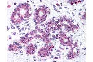 Anti-Estrogen Receptor antibody IHC of human breast. (ITIH1 antibody  (AA 410-592))