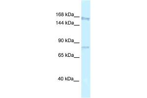 WB Suggested Anti-Arhgap5 Antibody   Titration: 1.
