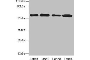 Western blot All lanes: TXNRD1 antibody at 5 μg/mL Lane 1: Jurkat whole cell lysate Lane 2: A549 whole cell lysate Lane 3: MCF-7 whole cell lysate Lane 4: Hela whole cell lysate Secondary Goat polyclonal to rabbit IgG at 1/10000 dilution Predicted band size: 71, 60, 66, 61, 55, 68, 51 kDa Observed band size: 60 kDa