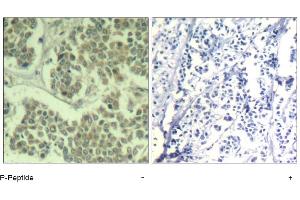 Image no. 1 for anti-Eukaryotic Translation Initiation Factor 2 Subunit 1 (EIF2S1) (pSer49) antibody (ABIN319276) (EIF2S1 antibody  (pSer49))