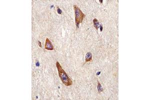 (ABIN6243251 and ABIN6577964) staining LRRK2 in Human brain tissue sections by Immunohistochemistry (IHC-P - paraformaldehyde-fixed, paraffin-embedded sections). (LRRK2 antibody  (C-Term))