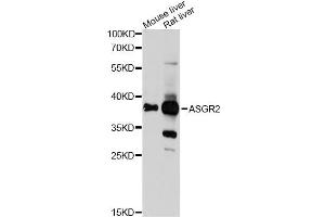 Western blot analysis of extracts of various cell lines, using ASGR2 Antibody (ABIN6290077) at 1:1000 dilution. (Asialoglycoprotein Receptor 2 antibody)