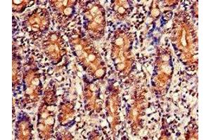 Immunohistochemistry of paraffin-embedded human small intestine tissue using ABIN7142858 at dilution of 1:100 (NUDT1 antibody  (AA 49-82))