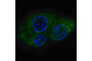 Fluorescent confocal image of HepG2 cells stained with FASN antibody. (Fatty Acid Synthase antibody  (AA 942-973))