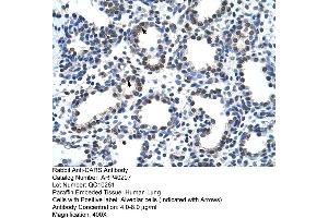 Rabbit Anti-CARS Antibody  Paraffin Embedded Tissue: Human Lung Cellular Data: Alveolar cells Antibody Concentration: 4. (CARS antibody  (N-Term))
