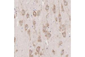 Immunohistochemical staining of human hippocampus with PREX1 polyclonal antibody  shows moderate cytoplasmic positivity in neuronal cells.