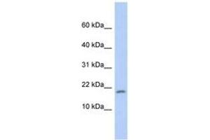 Image no. 1 for anti-Ribosomal Protein S15 (RPS15) (C-Term) antibody (ABIN6744000) (RPS15 antibody  (C-Term))
