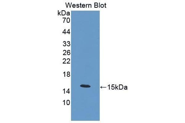 Calcitonin antibody  (AA 26-136)