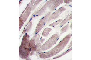 Formalin-fixed and paraffin-embedded human skeletal muscle tissue reacted with the P38 gamma antibody (C-term), which was peroxidase-conjugated to the secondary antibody, followed by DAB staining. (MAPK12 antibody  (C-Term))