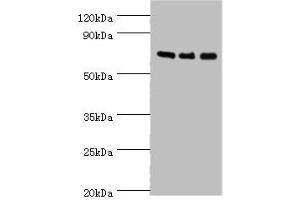 Western blot All lanes: AKAP10 antibody at 7 μg/mL Lane 1: 293T whole cell lysate Lane 2: Hela whole cell lysate Lane 3: HepG2 whole cell lysate Secondary Goat polyclonal to rabbit IgG at 1/10000 dilution Predicted band size: 74 kDa Observed band size: 74 kDa