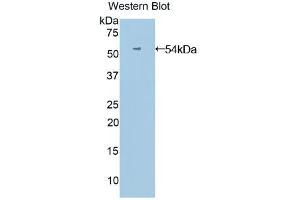 Western blot analysis of the recombinant protein. (ANGPTL3 antibody  (AA 17-460))
