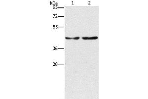 Western Blot analysis of Hela and 293T cell using CBX6 Polyclonal Antibody at dilution of 1:600 (CBX6 antibody)