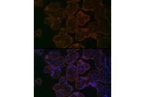 Immunofluorescence analysis of Human placenta using MYO5B antibody (ABIN6129305, ABIN6144287, ABIN6144288 and ABIN6224655) at dilution of 1:100. (MYO5B antibody  (AA 1440-1690))