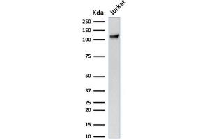 Western Blotting (WB) image for anti-Platelet/endothelial Cell Adhesion Molecule (PECAM1) antibody (ABIN6940280)