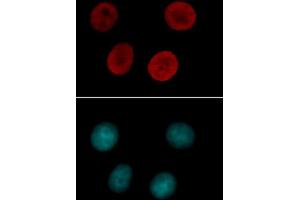Histone H4 acetyl Lys12 antibody tested by immunofluorescence. (Histone H4 antibody  (acLys12))