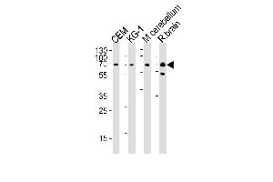 Western blot analysis of lysates from CEM, KG-1 cell line, mouse cerebellum and rat brain tissue lysate (from left to right), using MTF2 Antibody (Center) (ABIN1538252 and ABIN2849778). (MTF2 antibody  (AA 289-317))