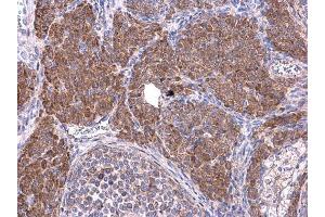 IHC-P Image Cyclin B1 antibody detects Cyclin B1 protein at cytoplasm on mouse ovary by immunohistochemical analysis. (Cyclin B1 antibody)