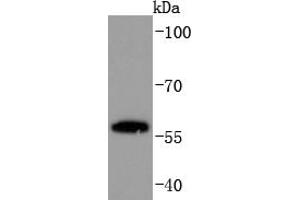 PC12 cell lysate probed with PPAR gamma (45G1) Monoclonal Antibody, Unconjugated  at 1:1000 overnight at 4˚C. (PPARG antibody)