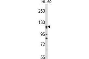 Western blot analysis of NOS3 Antibody (N-term) in HL-60 cell line lysates (35ug/lane).