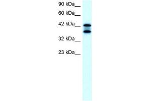 ACAT2 antibody used at 2 ug/ml to detect target protein.