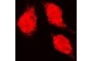 Immunofluorescent analysis of Glutathione Synthetase staining in K562 cells. (Glutathione Synthetase antibody)
