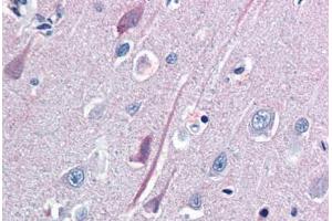 Human Brain, Cortex (formalin-fixed, paraffin-embedded) stained with TrkB antibody ABIN337266 at 10 ug/ml followed by biotinylated goat anti-rabbit IgG secondary antibody ABIN481713, alkaline phosphatase-streptavidin and chromogen. (TRKB antibody  (AA 1-429))