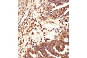 Immunohistochemical analysis of paraffin-embedded H. (PSMB2 antibody  (C-Term))