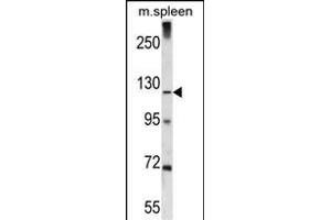 Antibody (C-term) (ABIN656481 and ABIN2845761) western blot analysis in mouse spleen tissue lysates (35 μg/lane).