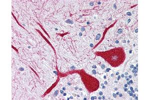 Anti-ITPR1 antibody IHC of human brain, cerebellum. (ITPR1 antibody  (AA 1892-1911))
