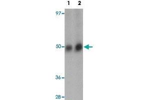 Western blot analysis of RNF8 in human lung tissue lysate with RNF8 polyclonal antibody  at (1) and (2) 2 ug/mL.