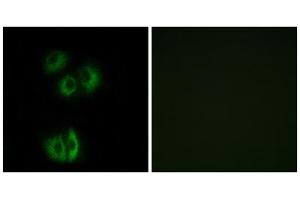 Immunofluorescence analysis of A549 cells, using CELSR3 antibody. (CELSR3 antibody  (C-Term))