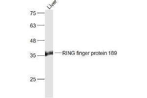 Mouse Liver lysates probed with RING finger protein 189 Polyclonal Antibody, Unconjugated  at 1:300 dilution and 4˚C overnight incubation.
