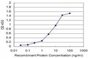 Detection limit for recombinant GST tagged CCT2 is approximately 0. (CCT2 antibody  (AA 117-217))