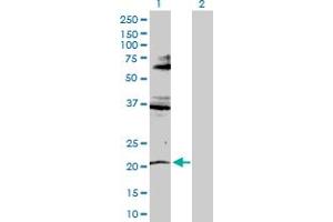 Western Blot analysis of RNF135 expression in transfected 293T cell line by RNF135 MaxPab polyclonal antibody. (RNF135 antibody  (AA 1-210))