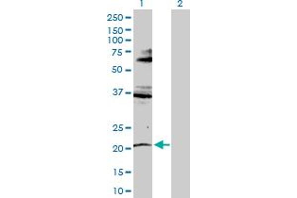 RNF135 anticorps  (AA 1-210)