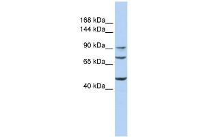 GALNT5 antibody used at 1 ug/ml to detect target protein.